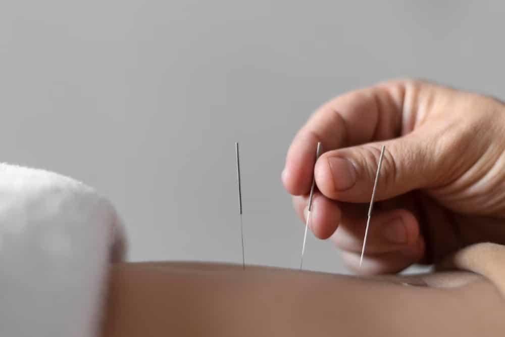 mano con utensilios acupuntura